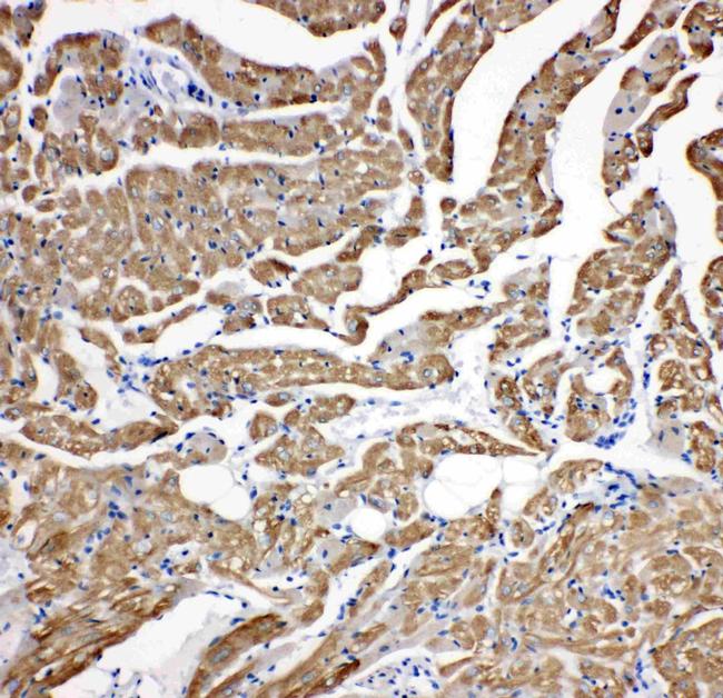 Cardiac Troponin C Antibody in Immunohistochemistry (Paraffin) (IHC (P))