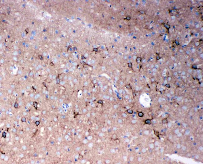 Tenascin R Antibody in Immunohistochemistry (Paraffin) (IHC (P))