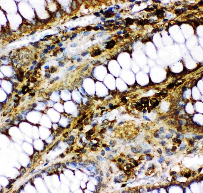 p73 Antibody in Immunohistochemistry (Paraffin) (IHC (P))