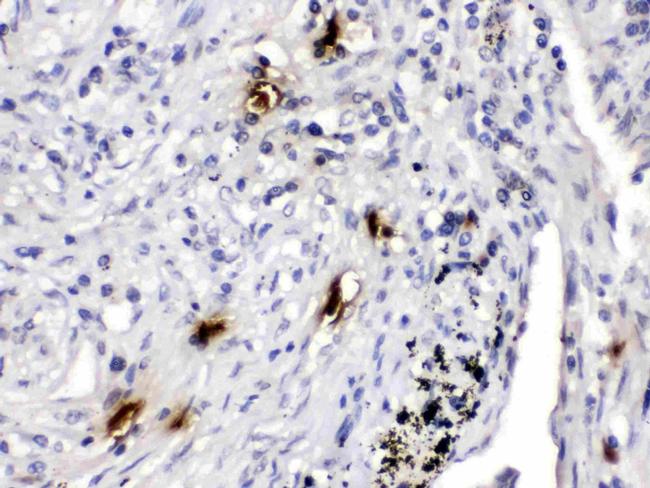 Tryptase Antibody in Immunohistochemistry (Paraffin) (IHC (P))