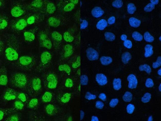 UBA2 Antibody in Immunocytochemistry (ICC/IF)