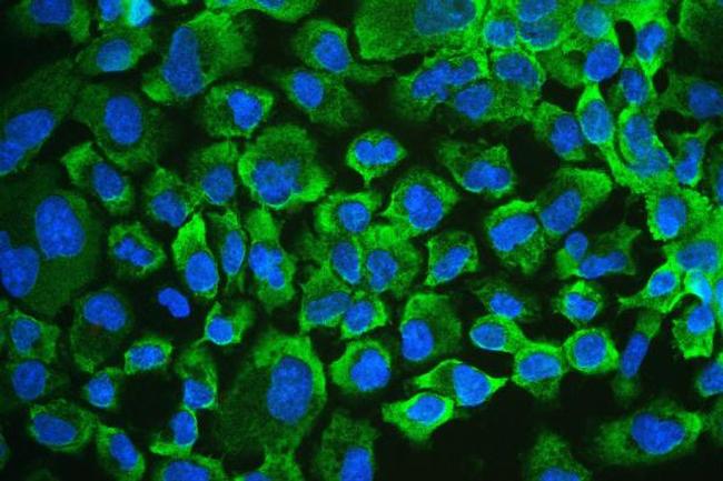 UPF1 Antibody in Immunocytochemistry (ICC/IF)