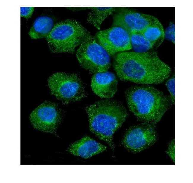 VAPB Antibody in Immunocytochemistry (ICC/IF)