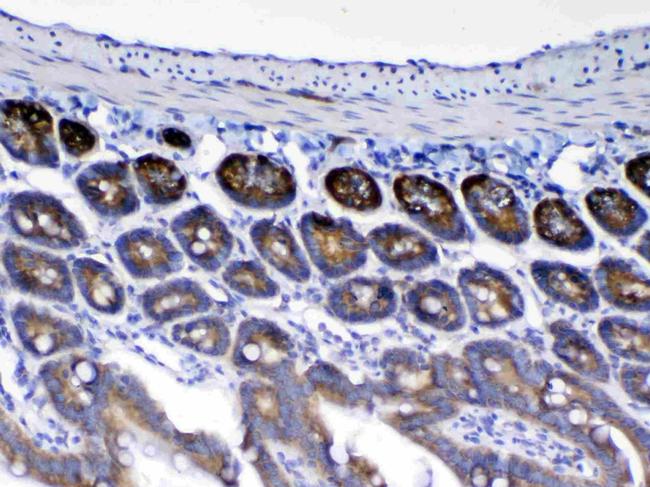 WFDC2 Antibody in Immunohistochemistry (Paraffin) (IHC (P))