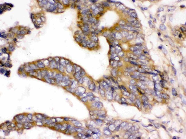 WNK1 Antibody in Immunohistochemistry (Paraffin) (IHC (P))