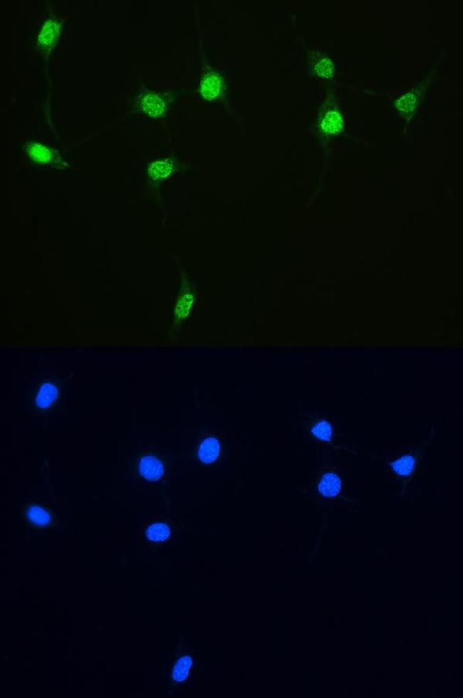 XRCC1 Antibody in Immunocytochemistry (ICC/IF)