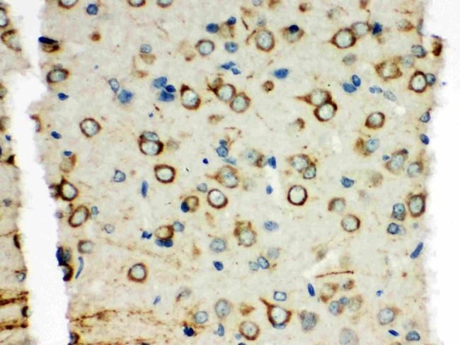 XRCC3 Antibody in Immunohistochemistry (Paraffin) (IHC (P))