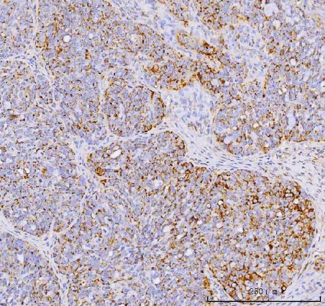 YBX1 Antibody in Immunohistochemistry (Paraffin) (IHC (P))