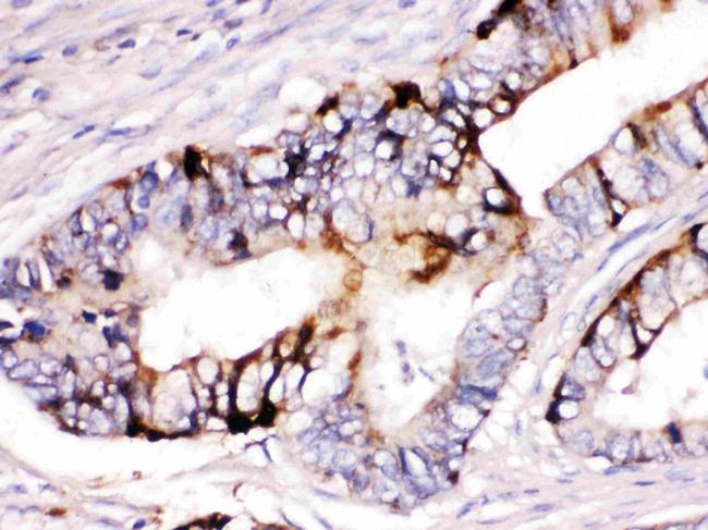 ZP2 Antibody in Immunohistochemistry (Paraffin) (IHC (P))