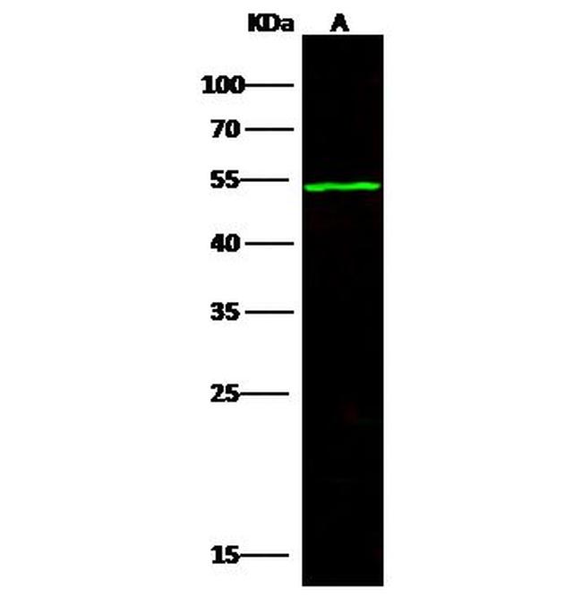 ACVR1B Antibody in Western Blot (WB)