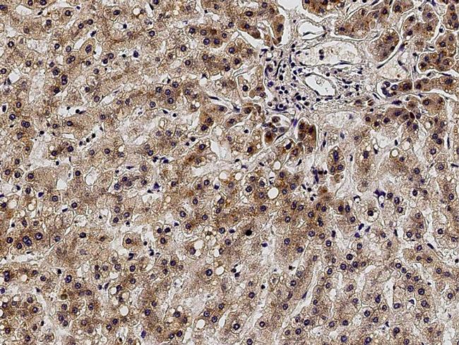 ACVRL1 Antibody in Immunohistochemistry (Paraffin) (IHC (P))