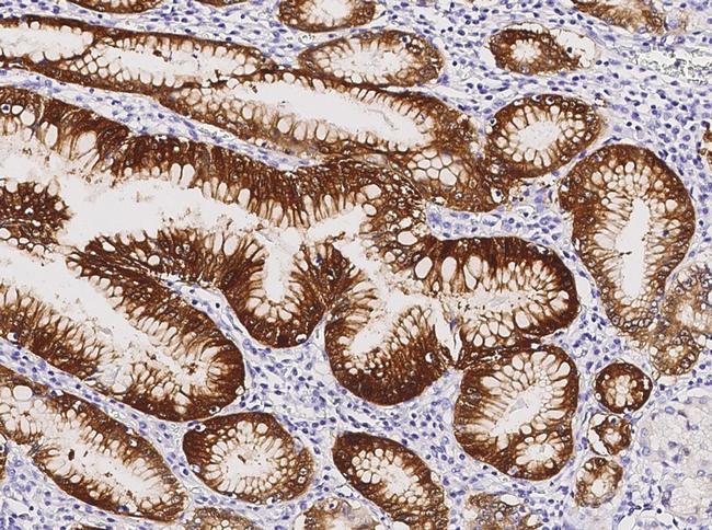 ALDH3A1 Antibody in Immunohistochemistry (Paraffin) (IHC (P))