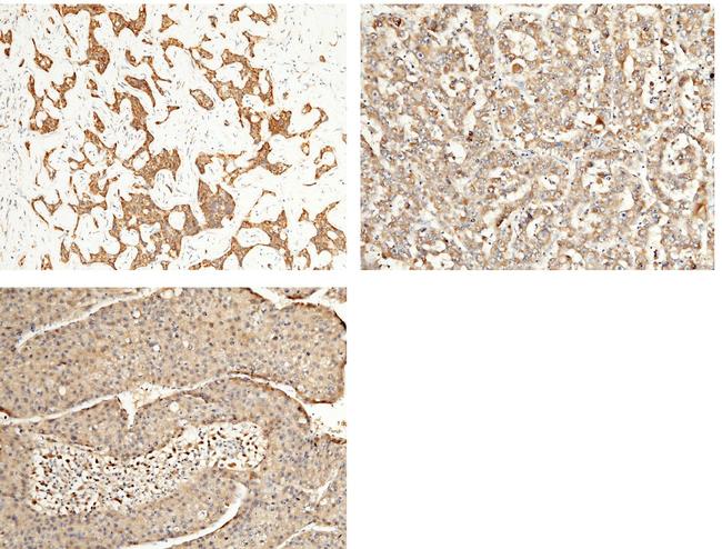 ALDH7A1 Antibody in Immunohistochemistry (Paraffin) (IHC (P))