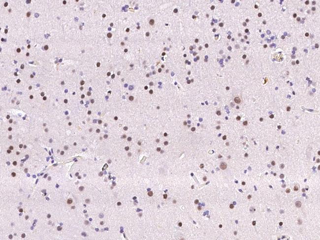 ATF Antibody in Immunohistochemistry (Paraffin) (IHC (P))