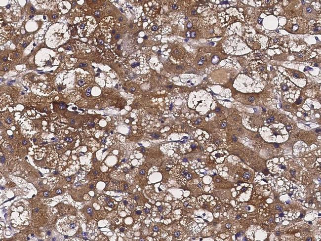 ATOX1 Antibody in Immunohistochemistry (Paraffin) (IHC (P))