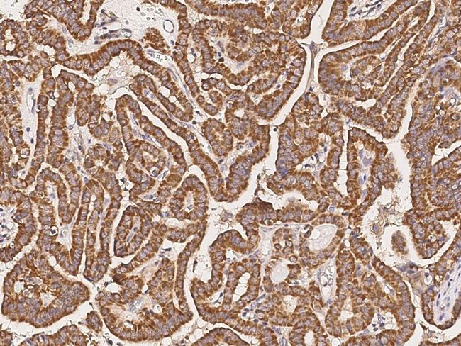 ATPIF1 Antibody in Immunohistochemistry (Paraffin) (IHC (P))