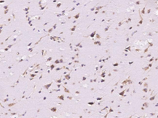 B3GAT3 Antibody in Immunohistochemistry (Paraffin) (IHC (P))