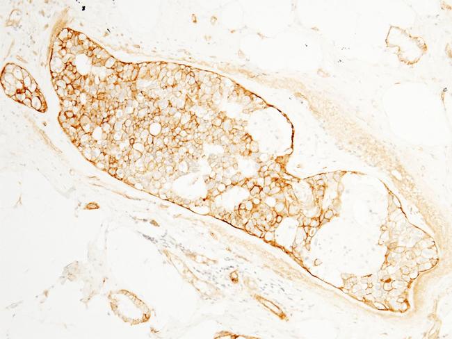 BCAM Antibody in Immunohistochemistry (Paraffin) (IHC (P))