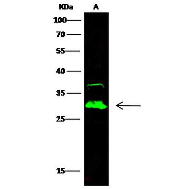 Carbonic Anhydrase II Antibody in Western Blot (WB)