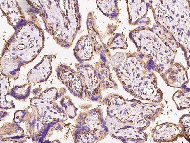 Calreticulin Antibody in Immunohistochemistry (Paraffin) (IHC (P))