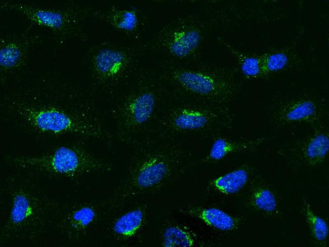 MCP-1 Antibody in Immunocytochemistry (ICC/IF)