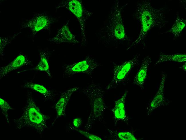 CDK4 Antibody in Immunocytochemistry (ICC/IF)