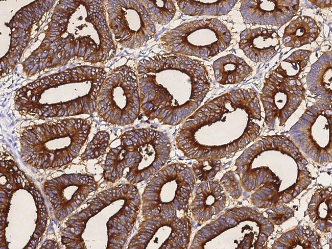 CEACAM1 Antibody in Immunohistochemistry (Paraffin) (IHC (P))