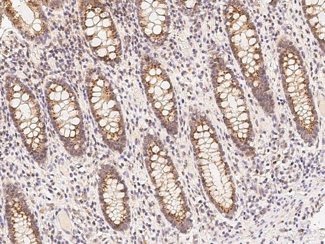 Claudin 3 Antibody in Immunohistochemistry (Paraffin) (IHC (P))