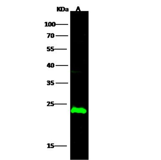 CMPK1 Antibody in Western Blot (WB)