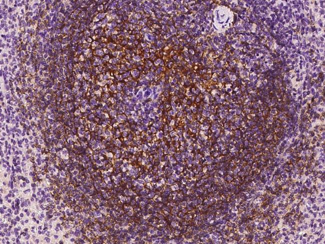 CD21 Antibody in Immunohistochemistry (Paraffin) (IHC (P))