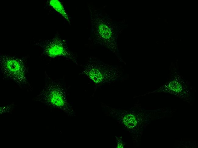 RAIDD Antibody in Immunocytochemistry (ICC/IF)