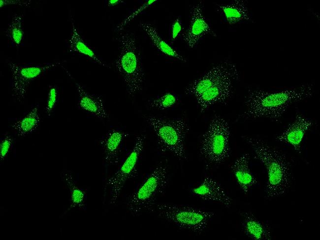 CK2 alpha-2 Antibody in Immunocytochemistry (ICC/IF)