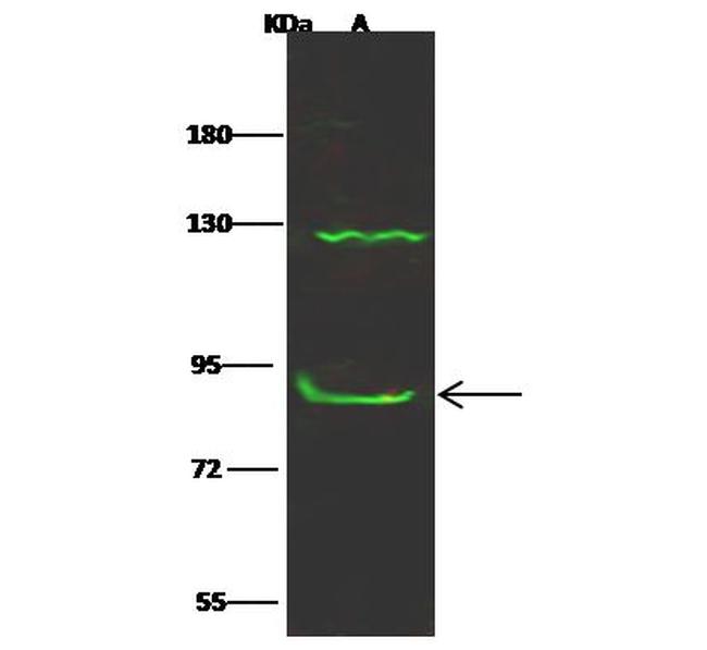 CTNNA3 Antibody in Western Blot (WB)