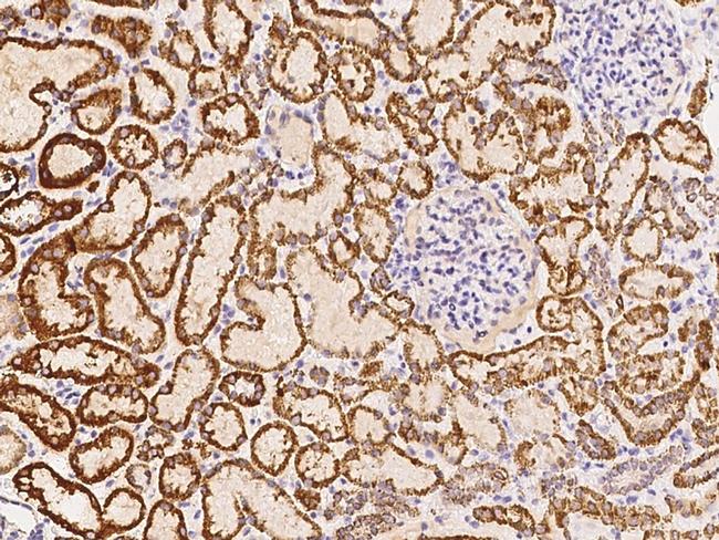 DECR1 Antibody in Immunohistochemistry (Paraffin) (IHC (P))