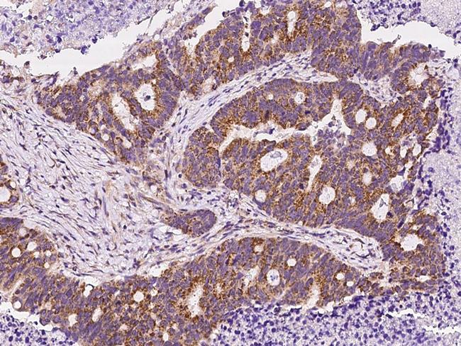 DKK3 Antibody in Immunohistochemistry (Paraffin) (IHC (P))