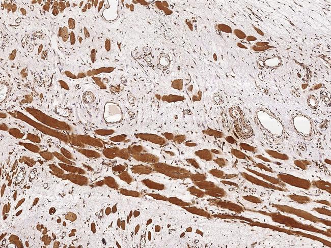 RCAS1 Antibody in Immunohistochemistry (Paraffin) (IHC (P))