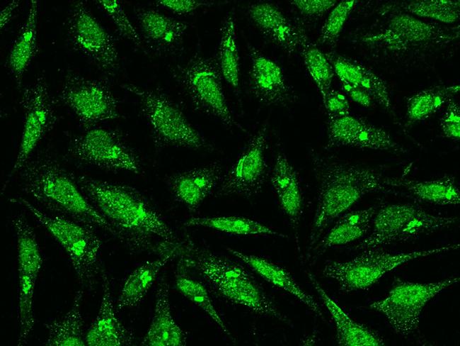 EHD2 Antibody in Immunocytochemistry (ICC/IF)