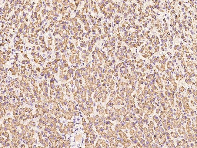 ENPP2 Antibody in Immunohistochemistry (Paraffin) (IHC (P))