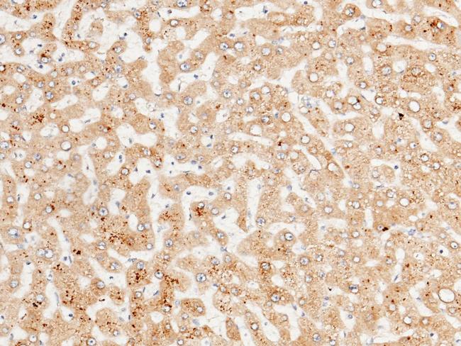 ENTPD5 Antibody in Immunohistochemistry (Paraffin) (IHC (P))