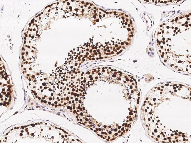 ETV5 Antibody in Immunohistochemistry (Paraffin) (IHC (P))