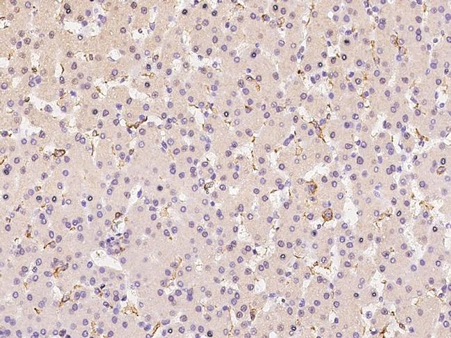 CD16 Antibody in Immunohistochemistry (Paraffin) (IHC (P))