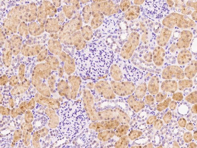 FUOM Antibody in Immunohistochemistry (Paraffin) (IHC (P))