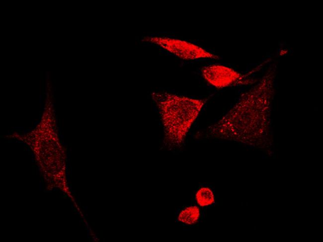 GMFB Antibody in Immunocytochemistry (ICC/IF)