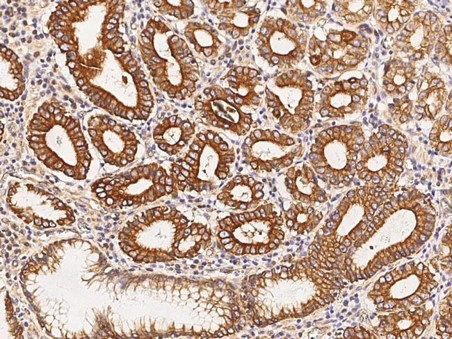 PIST Antibody in Immunohistochemistry (Paraffin) (IHC (P))