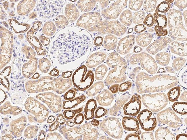 GSTM5 Antibody in Immunohistochemistry (Paraffin) (IHC (P))