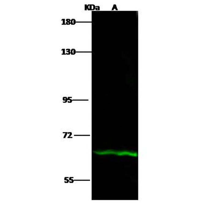 IL12RB1 Antibody in Western Blot (WB)