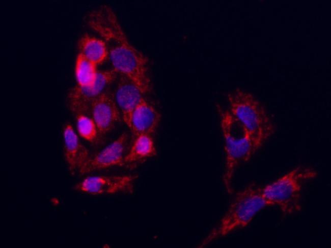 CD103 Antibody in Immunocytochemistry (ICC/IF)