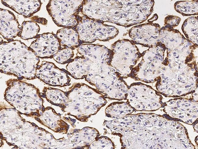 CD51 Antibody in Immunohistochemistry (Paraffin) (IHC (P))