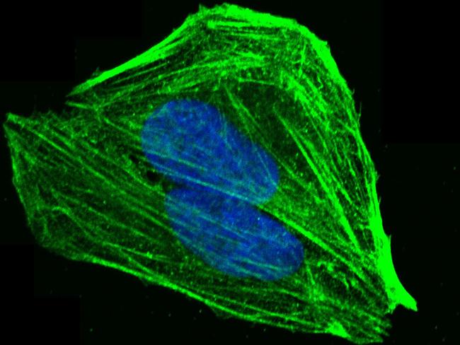 L-Plastin Antibody in Immunocytochemistry (ICC/IF)