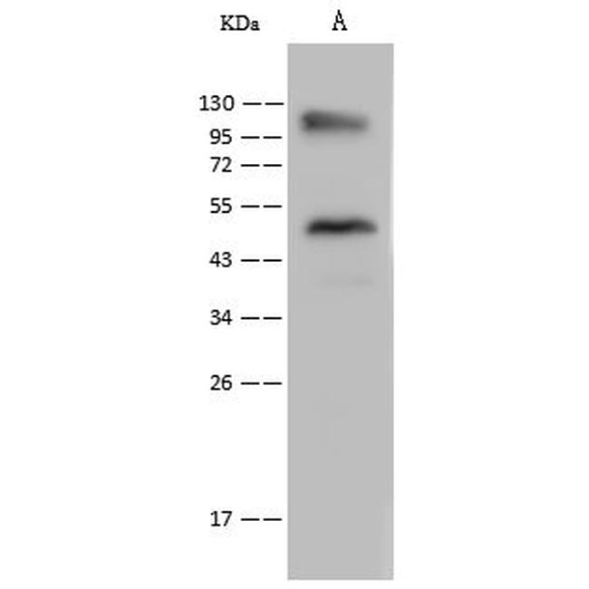 LRRC8D Antibody in Western Blot (WB)